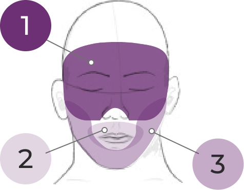 Sketch of head showing 3 sites for movement ratings as areas shaded in purple, with a callout line between the number 1 and the muscles of facial expression, a callout line between the number 2 and the lips and perioral area, and a callout line between the number 3 and the jaw.